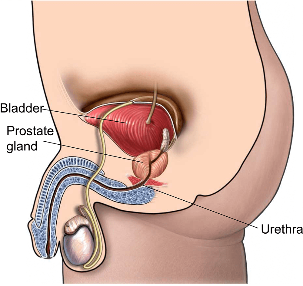 Prostate surgery $3500-$4000