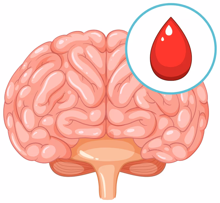 Blood Clot Brain Surgery