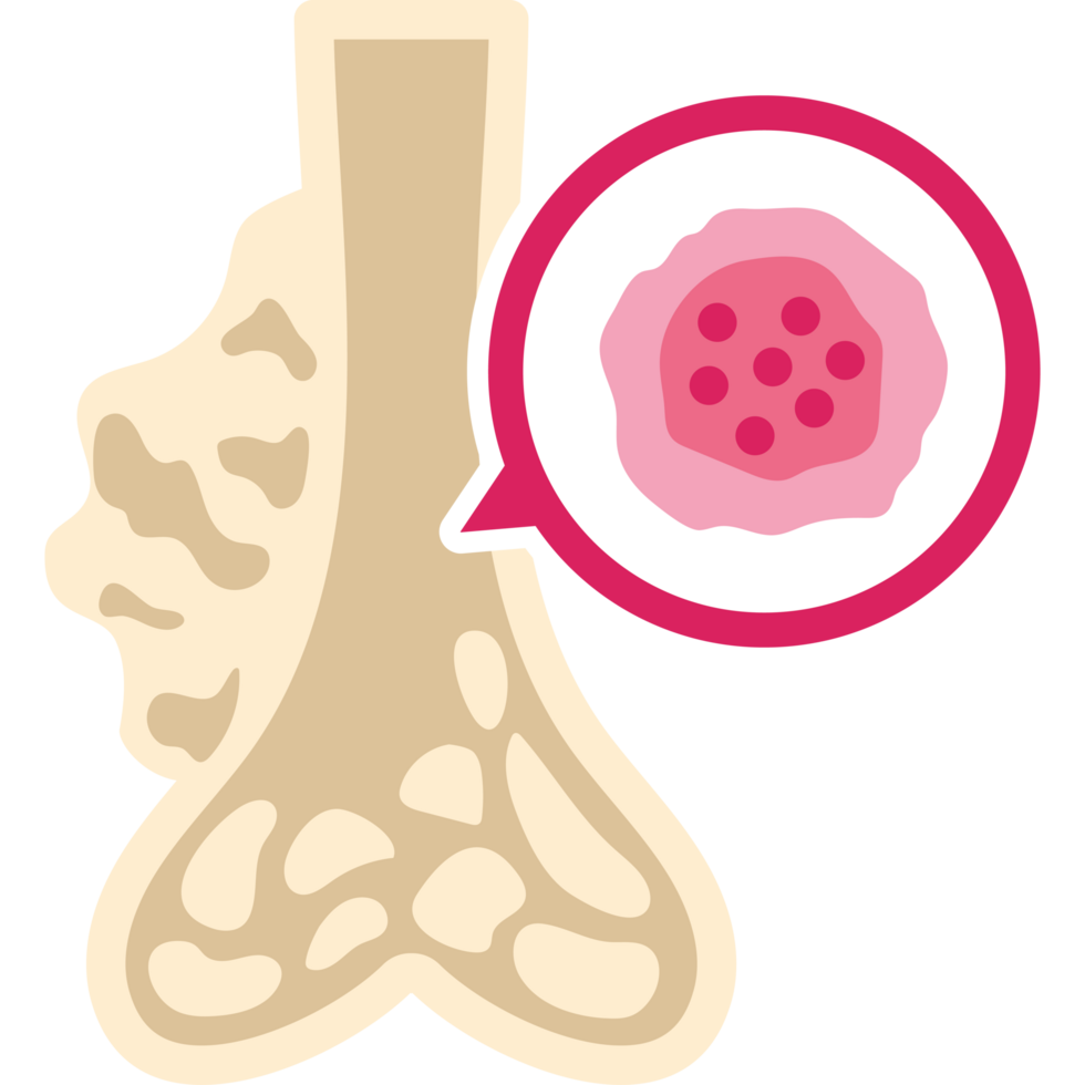 Bone Marrow Transplant (BMT) $13,500-$16,500